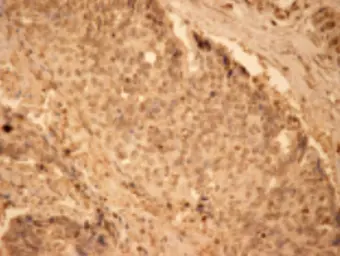 Anti-SOD1 antibody used in Immunohistochemistry (IHC). GTX13498