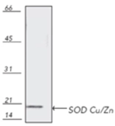 Anti-SOD1 antibody used in Western Blot (WB). GTX13499