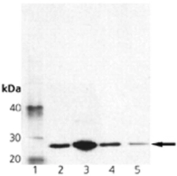 Anti-Membrin antibody [4HAD6] used in Western Blot (WB). GTX13511