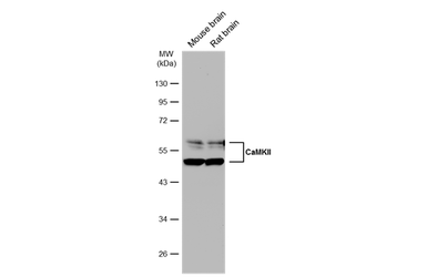 Anti-CaMKII antibody used in Western Blot (WB). GTX135117