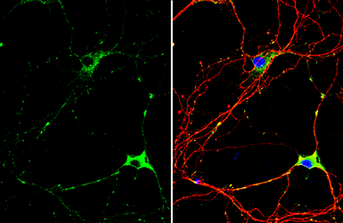 Anti-CaMKII antibody used in Immunocytochemistry/ Immunofluorescence (ICC/IF). GTX135117