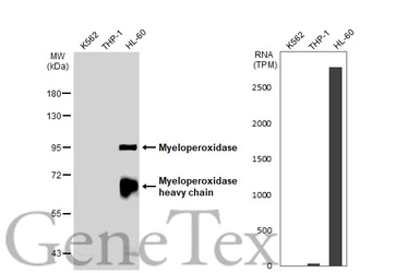 Anti-Myeloperoxidase antibody used in Western Blot (WB). GTX135127