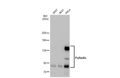 Anti-Palladin antibody used in Western Blot (WB). GTX135128