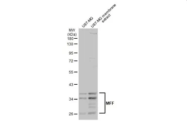 Anti-MFF antibody used in Western Blot (WB). GTX135140