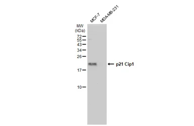 Anti-p21 Cip1 antibody used in Western Blot (WB). GTX135142