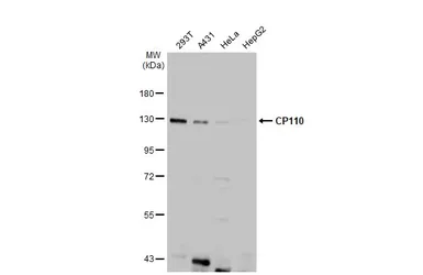 Anti-CP110 antibody used in Western Blot (WB). GTX135150