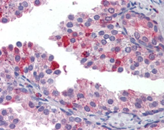 Anti-TAP1 antibody used in Immunohistochemistry (IHC). GTX13516