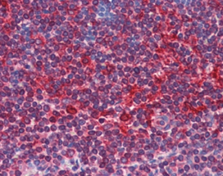 Anti-TAP1 antibody used in Immunohistochemistry (IHC). GTX13516