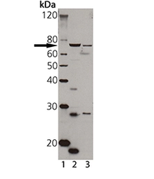 Anti-TAP1 antibody used in Western Blot (WB). GTX13516