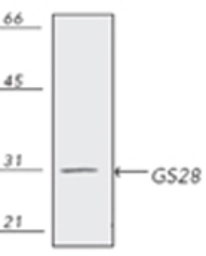 Anti-GOSR1 antibody [HFD9-5] used in Western Blot (WB). GTX13522