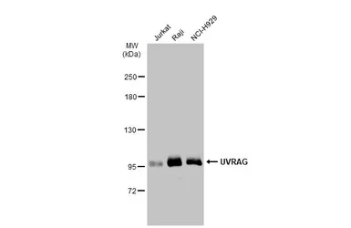 Anti-UVRAG antibody used in Western Blot (WB). GTX135222