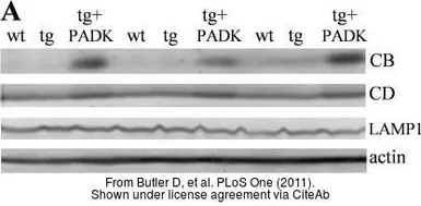 Anti-LAMP1 antibody [Ly1C6] used in Western Blot (WB). GTX13523