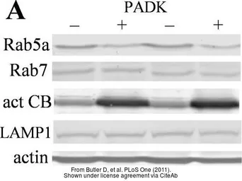 Anti-LAMP1 antibody [Ly1C6] used in Western Blot (WB). GTX13523