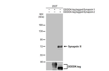 Anti-Synapsin II antibody used in Western Blot (WB). GTX135273