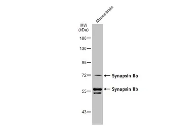 Anti-Synapsin II antibody used in Western Blot (WB). GTX135273