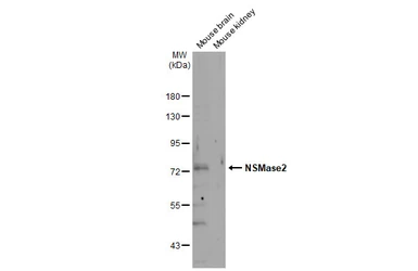 Anti-NSMase2 antibody used in Western Blot (WB). GTX135275