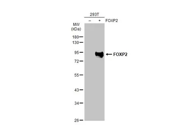 Anti-FOXP2 antibody used in Western Blot (WB). GTX135285