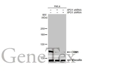 Anti-CRM1 antibody used in Western Blot (WB). GTX135287