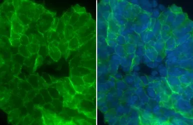 Anti-CD9 antibody used in Immunocytochemistry/ Immunofluorescence (ICC/IF). GTX135296