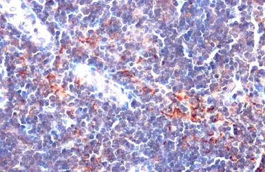 Anti-CD81 antibody used in IHC (Paraffin sections) (IHC-P). GTX135297