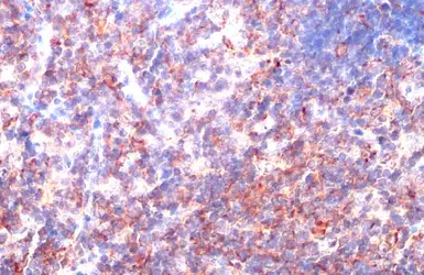 Anti-CD81 antibody used in IHC (Paraffin sections) (IHC-P). GTX135297