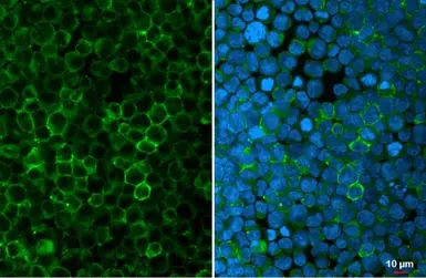 Anti-CD81 antibody used in Immunocytochemistry/ Immunofluorescence (ICC/IF). GTX135297