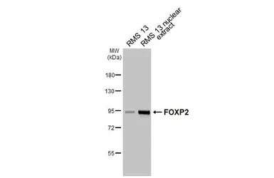 Anti-FOXP2 antibody used in Western Blot (WB). GTX135298