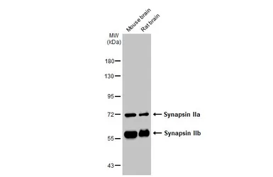 Anti-Synapsin II antibody used in Western Blot (WB). GTX135310
