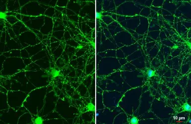 Anti-Synapsin II antibody used in Immunocytochemistry/ Immunofluorescence (ICC/IF). GTX135310