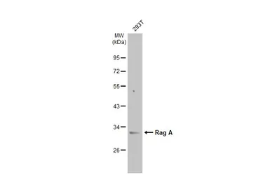 Anti-Rag A antibody used in Western Blot (WB). GTX135318