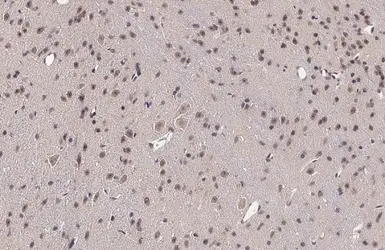 Anti-Rag A antibody used in IHC (Paraffin sections) (IHC-P). GTX135318