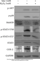 Anti-SOD2 antibody used in Western Blot (WB). GTX13533