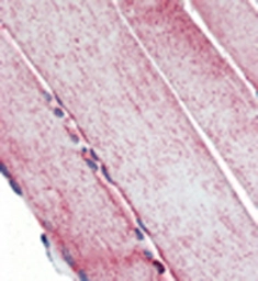 Anti-SOD2 antibody used in Immunohistochemistry (IHC). GTX13533