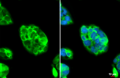 Anti-Fibrinogen antibody used in Immunocytochemistry/ Immunofluorescence (ICC/IF). GTX135332