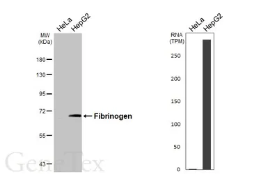 Anti-Fibrinogen antibody used in Western Blot (WB). GTX135332