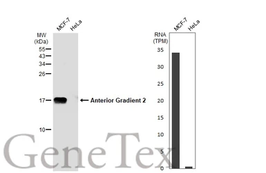 Anti-Anterior Gradient 2 antibody used in Western Blot (WB). GTX135343