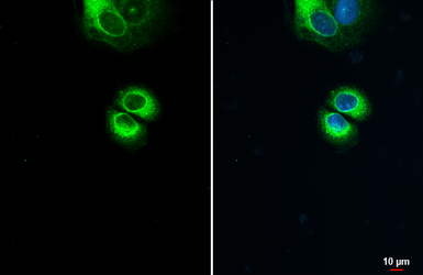 Anti-Anterior Gradient 2 antibody used in Immunocytochemistry/ Immunofluorescence (ICC/IF). GTX135343