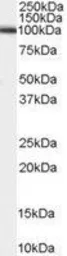 Anti-ADAM17 antibody used in Western Blot (WB). GTX13535