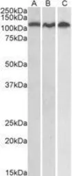 Anti-ADAM17 antibody used in Western Blot (WB). GTX13535