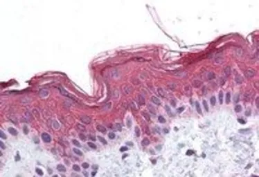 Anti-ADAM17 antibody used in IHC (Paraffin sections) (IHC-P). GTX13535