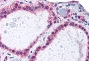 Anti-ADAM17 antibody used in IHC (Paraffin sections) (IHC-P). GTX13535