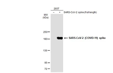 Anti-SARS-CoV-2 (COVID-19) Spike antibody used in Western Blot (WB). GTX135356