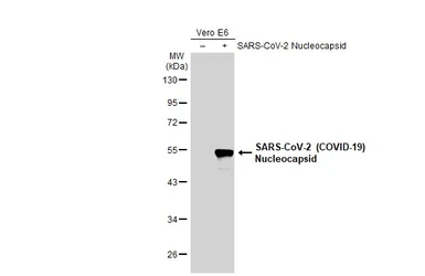 Anti-SARS-CoV-2 (COVID-19) Nucleocapsid antibody used in Western Blot (WB). GTX135357