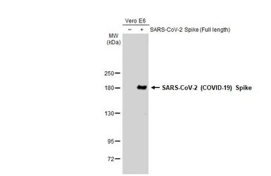 Anti-SARS-CoV-2 (COVID-19) Spike antibody used in Western Blot (WB). GTX135360