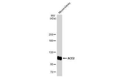 Anti-ACE2 antibody used in Western Blot (WB). GTX135406