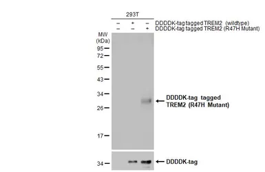 Anti-TREM2 (R47H Mutant) antibody used in Western Blot (WB). GTX135408