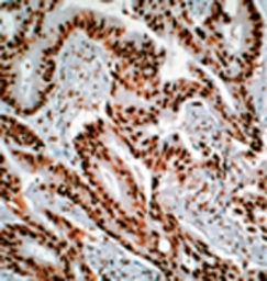 Anti-Nucleolin antibody [4E2] used in Immunohistochemistry (IHC). GTX13541