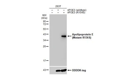 Anti-Apolipoprotein E (R136S Mutant) antibody used in Western Blot (WB). GTX135410