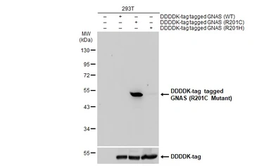 Anti-GNAS (R201C Mutant) antibody used in Western Blot (WB). GTX135412
