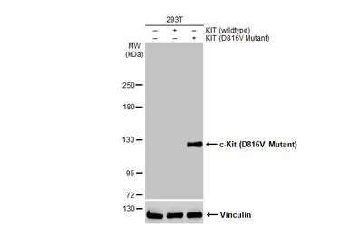 Anti-c-Kit (D816V Mutant) antibody used in Western Blot (WB). GTX135431